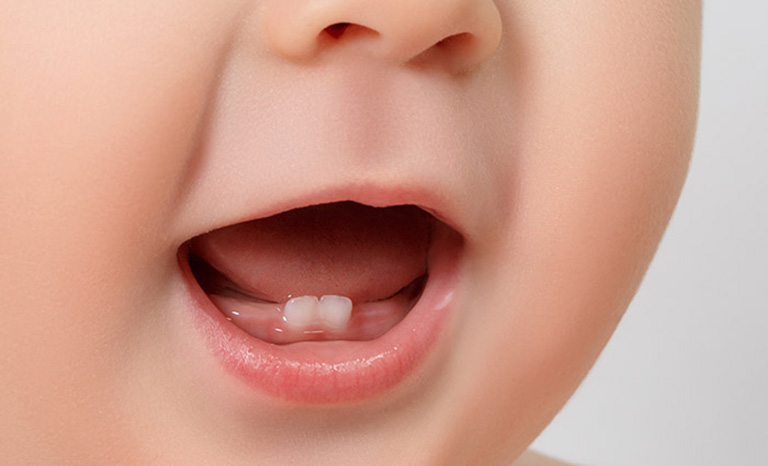 Bài tập cơ miệng cho trẻ chậm nói