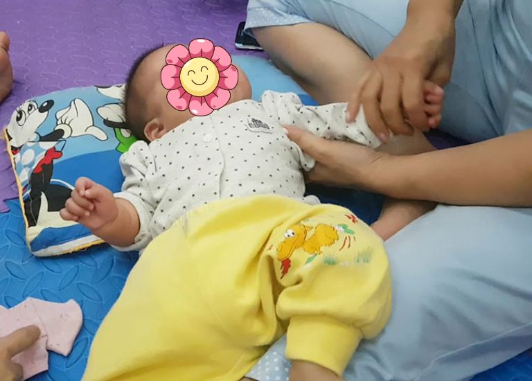 Tăng trương lực cơ khiến con trẻ đau đớn khó chịu, đi lại khó khăn không vững vàng